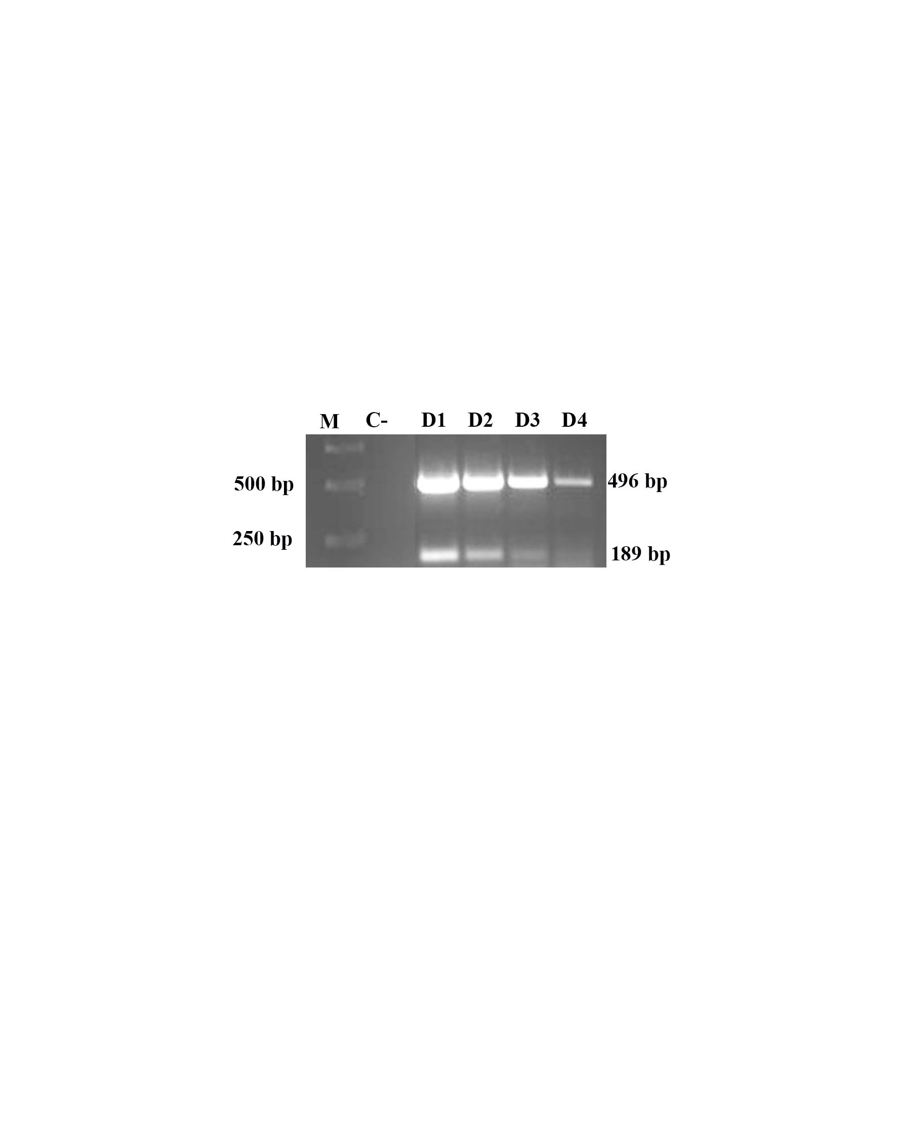 Figure 3. Sensitivity of duplex PCR