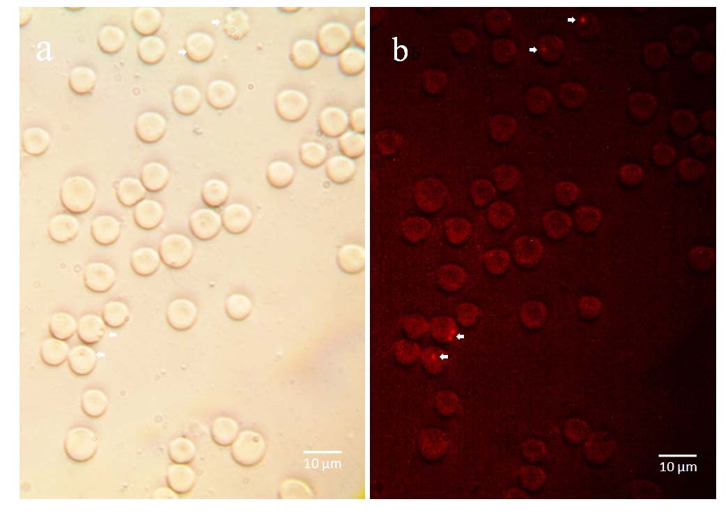 Figure 4. Representative micrograph of hemoplasmas stained with propidium iodide