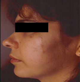 fig2